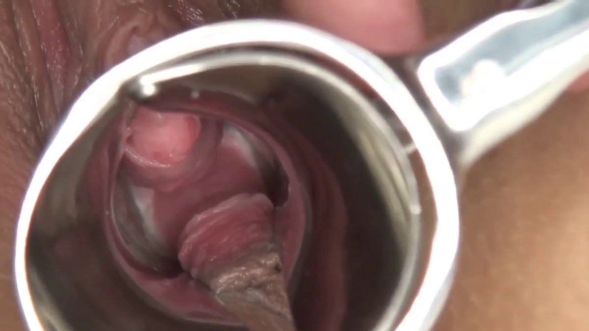 迷玩双马尾邻家美眉 小贫乳蝴蝶穴 被各种玩弄 无套输出 内射满满一鲍鱼迷玩