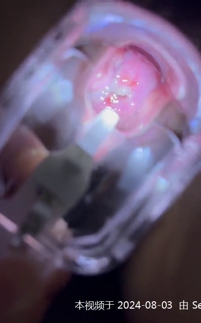 用扩阴器查看母狗的子宫