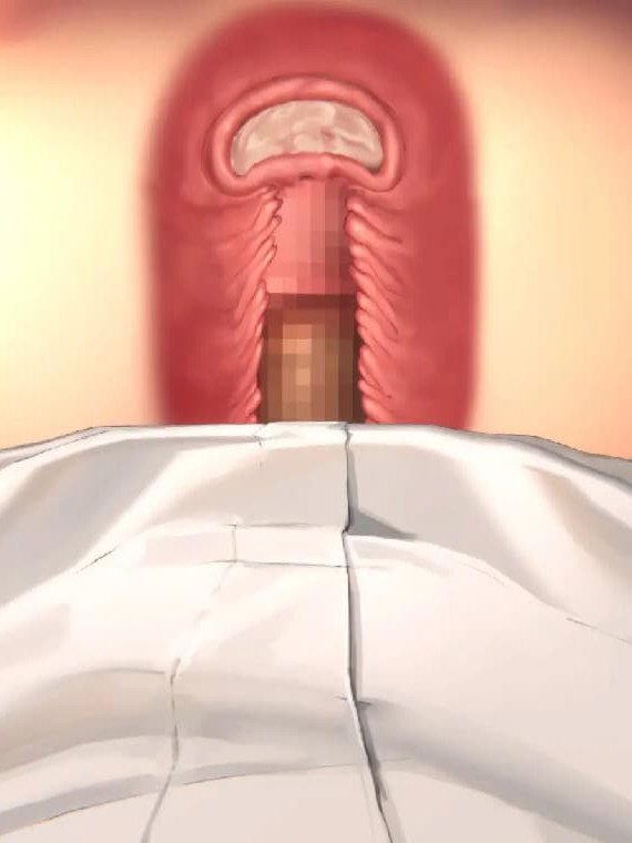 SLG/全动态/黑丝JK/中出丨教室里的屁股R 教室でお尻R 正式版 【20260211】