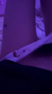 剃阴毛前和剃阴毛后